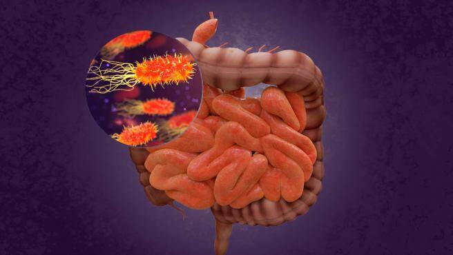Permeabilidad intestinal: qué es y cómo tratar sus alteraciones con probióticos y alimentación￼
