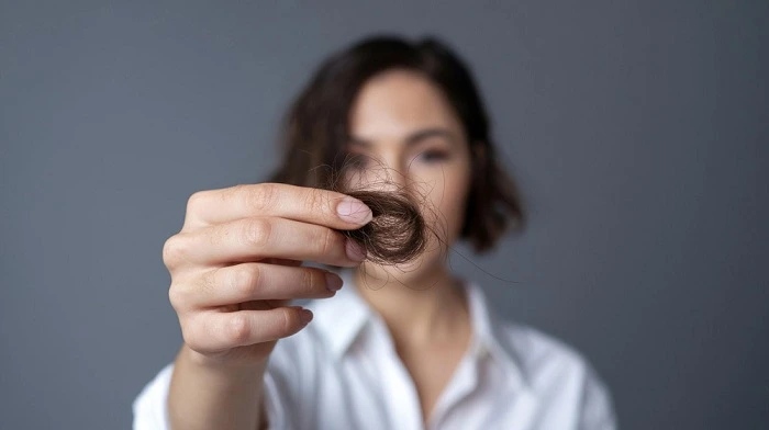 alimentos prohibidos para la caída del cabello